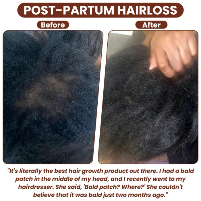 Grows Pure Batana Oil - Image 5