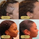 Houdini Vegan Hair Growth Oil - Image 3